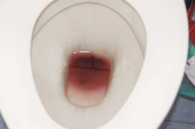 ლაქა მამაკაცებში აღგზნებისას